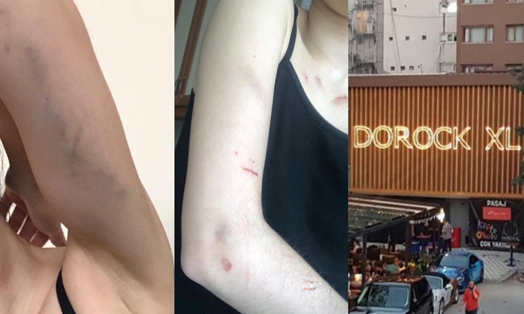 Beşiktaş'taözel güvenliği tarafından  barda kadın müşteriye darp iddiası