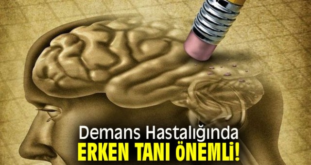 DEMANS HASTALIĞINDA ERKEN TANI ÖNEMLİ