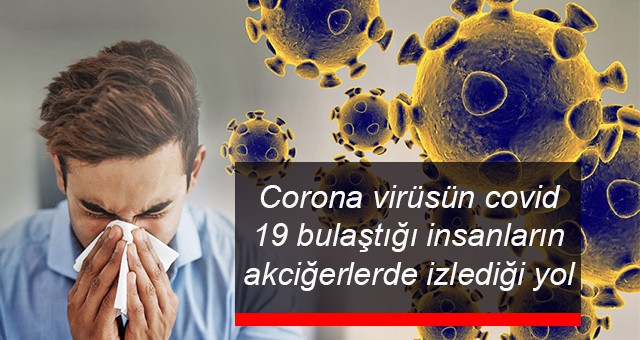 Corona virüsün covid 19 bulaştığı insanların akciğerlerde izlediği yol
