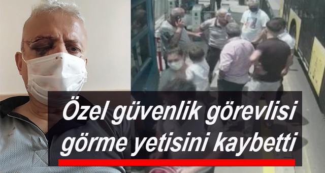 Özel güvenlik görevlisi görme yetisini kaybetti