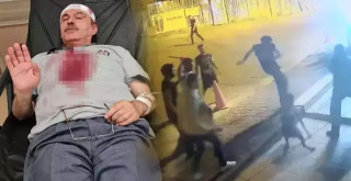 Özel Güvenlik görevlisi ile köpeği dehşeti yaşadı
